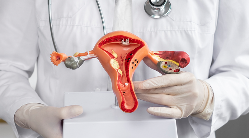 VIVV Clinic บริการตรวจคัดกรองมะเร็งปากมดลูก