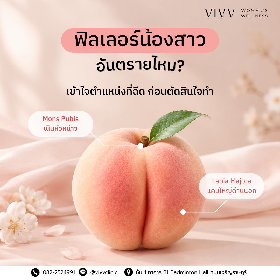VIVV Clinic : ฟิลเลอร์น้องสาวอันตรายไหม? เข้าใจให้ถูกก่อนตัดสินใจฉีด